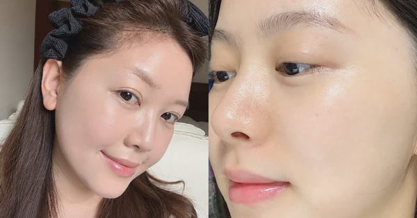 3 kem dưỡng tăng sinh collagen, đẩy rãnh nhăn từ sâu bên trong chỉ dành cho U.35+