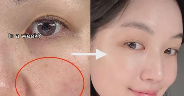 +3 kem retinol khiến chị em giật mình vì da căng bóng glowy, muốn già cũng khó