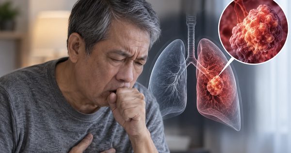 3 trường hợp không có triệu chứng vẫn nên tầm soát ung thư