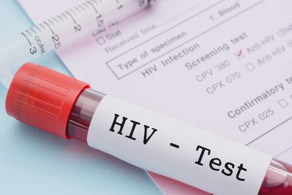 31% ca nhiễm HIV mới được phát hiện tại TPHCM