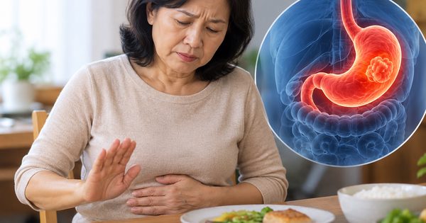4 dấu hiệu ung thư dạ dày dễ bị nhầm với rối loạn tiêu hóa