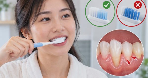 6 lỗi khi đánh răng có thể hại răng, tổn thương nướu