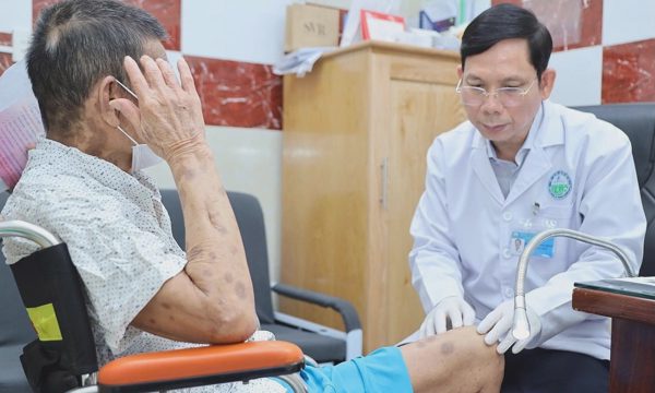 'Ác mộng' đau thần kinh sau khi bệnh zona lành