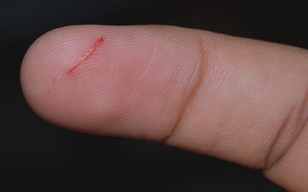 Bác sĩ cảnh báo 5 dấu hiệu báo động hệ miễn dịch 'yếu ớt'