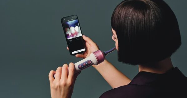 Bàn chải điện đầu tiên trên thế giới trang bị camera AI