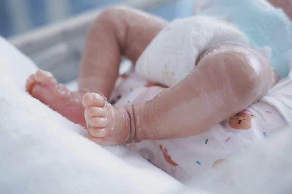 Bé trai ở TPHCM mắc căn bệnh hiếm gặp, vừa sinh ra đã có "vảy cá"