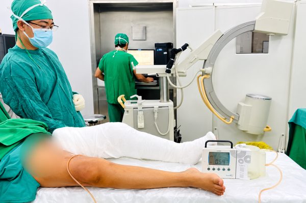 Bé trai phải bò vì sẹo bỏng làm co rút chân