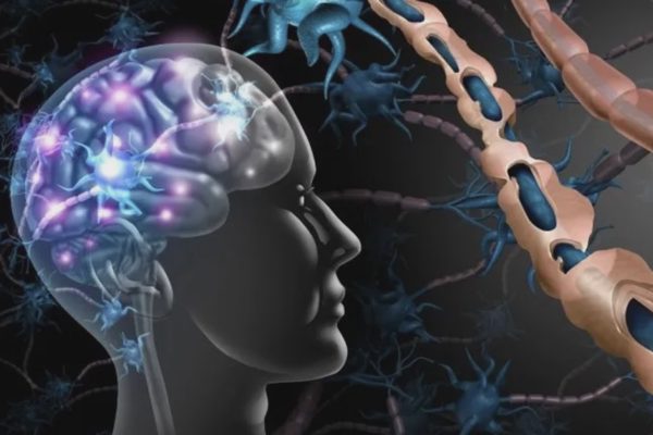 Bệnh hiểm khiến người mắc đột ngột giảm thị lực, rối loạn tiểu tiện