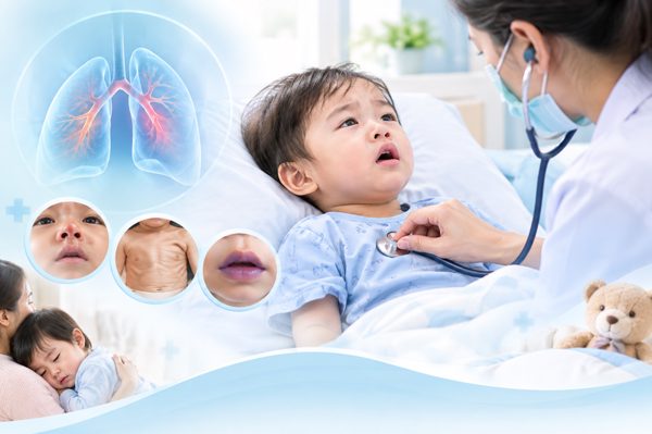 Bệnh hô hấp ở trẻ nhỏ có thể chuyển nặng nhanh: Khi nào cần đưa trẻ đi cấp cứu?