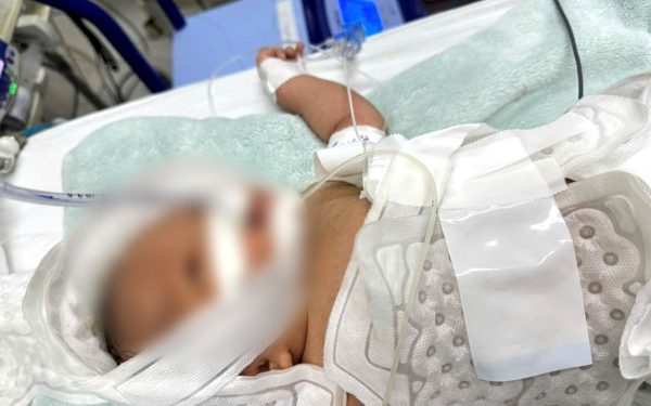 Bệnh viện Nhi đồng TP Cần Thơ lần đầu dùng kỹ thuật hạ thân nhiệt chỉ huy chữa trẻ sơ sinh bị thiếu oxy não