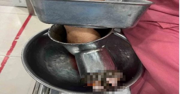 Bị máy xay thịt 'nuốt' bàn tay, người phụ nữ ở TP.HCM phải cắt cụt 3 ngón