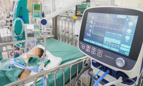 Biến chứng não hoại tử khi trẻ mắc cúm A