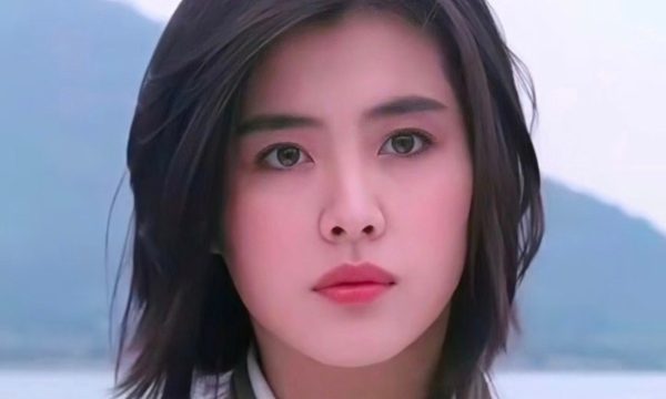Biểu tượng nhan sắc lên tiếng về gương mặt biến dạng