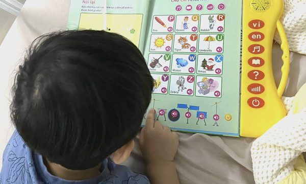 Bốn hiểu lầm thường gặp về lác mắt ở trẻ sơ sinh