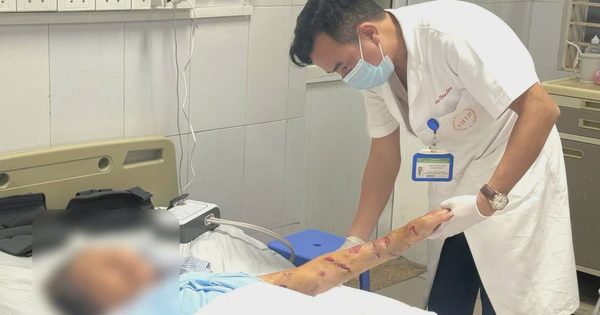 Cẩn trọng khi nhà có chó nuôi con