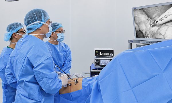 Cắt túi mật có ảnh hưởng đến tiêu hóa?