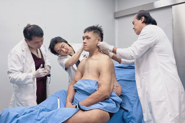 Chàng trai giảm hơn 160kg, cắt 17kg da thừa sau giảm cân