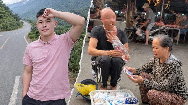 Chàng trai nghị lực mang khuôn mặt dị nhân bán hàng giữa chợ
