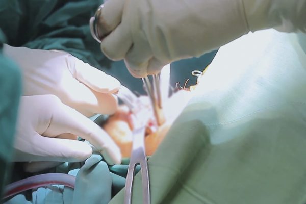 Chạy xe máy tông phải chó thả rông, người đàn ông chấn thương nghiêm trọng