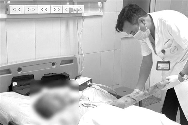 Chó nhà tấn công người đàn ông nằm liệt giường