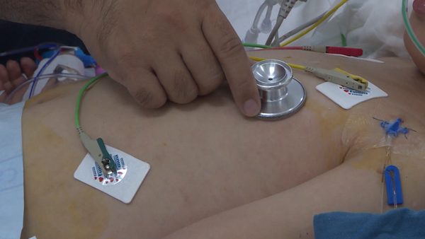 Chủ động phòng bệnh não mô cầu