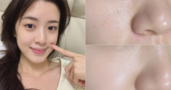 Da 30+ muốn căng bóng như tuổi 25: +5 serum chống lão hóa giúp da căng bóng
