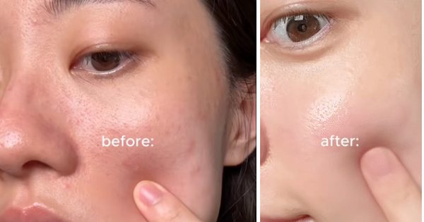 Da càng chăm càng già? Do bạn đang thiếu bước skincare retinol cho da lão hóa