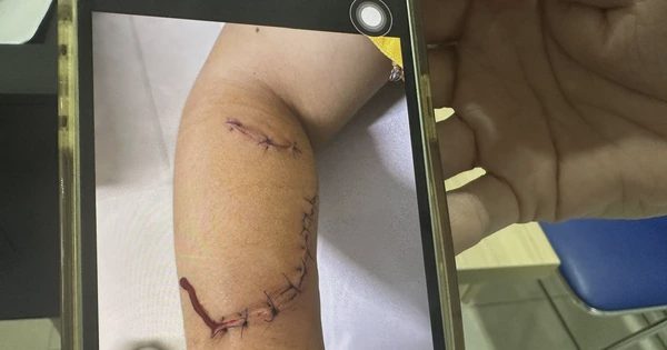 Đắk Lắk chỉ đạo làm rõ 2 vụ nữ sinh đánh nhau