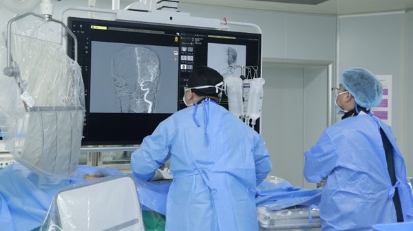 Đặt stent đổi hướng dòng chảy cứu người bệnh có túi phình động mạch cảnh chỗ gập góc