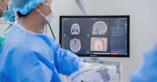 Đau đầu dai dẳng sau mổ xoang, phát hiện ổ mủ sát sàn sọ