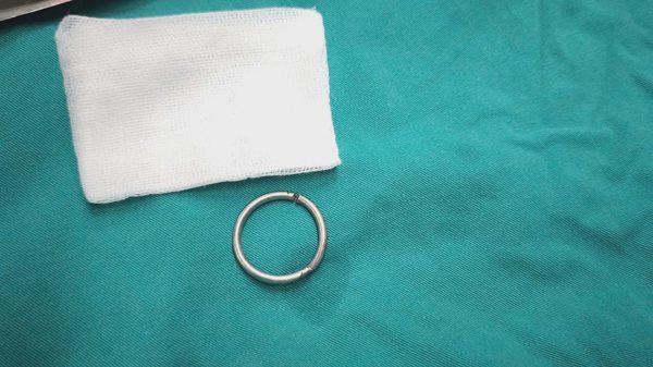 Đeo vòng kim loại tăng khoái cảm, thanh niên 24 tuổi suýt hoại tử vùng kín