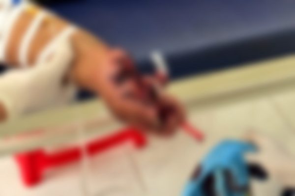 Điện thoại đang sạc phát nổ, thiếu niên bị thương nặng