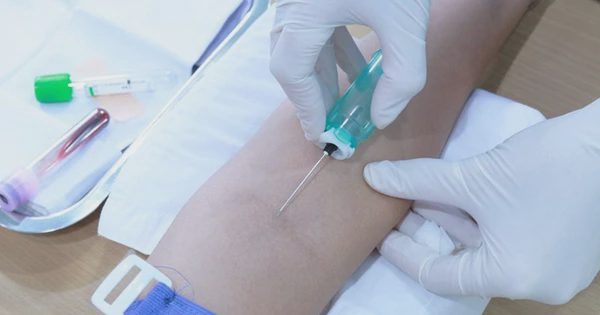 Điều kiện hưởng 100% quyền lợi khi bảo hiểm y tế đủ 5 năm liên tục
