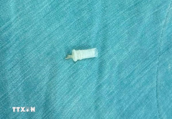 Đồng Nai: Cấp cứu thành công bé trai 11 tuổi bị hóc kèn đồ chơi