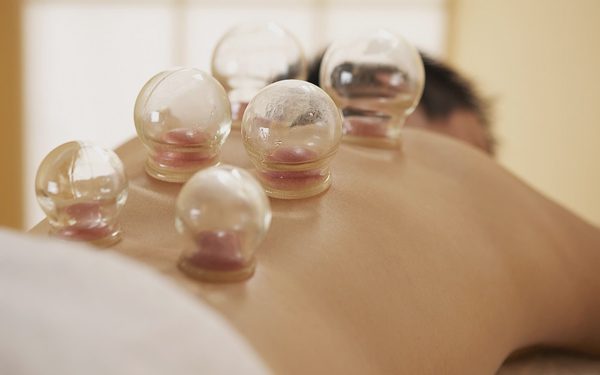 Giác hơi hút máu chữa được đột quỵ?