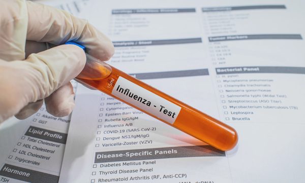Giới khoa học theo dõi biến đổi của H1N1 để dự báo mùa cúm