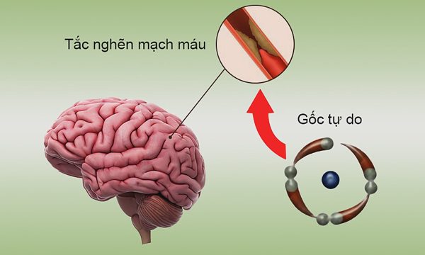 Gốc tự do tấn công gây hại não thế nào