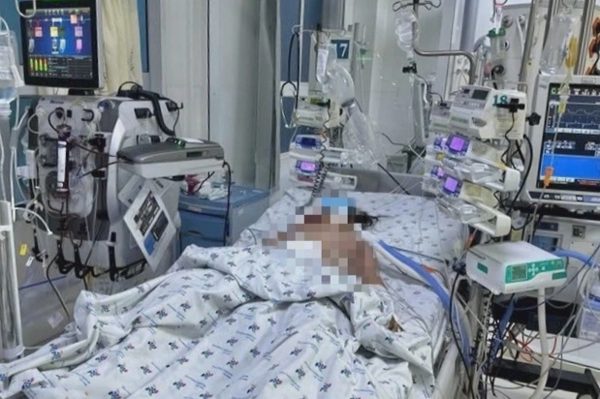 Hai trẻ sốt xuất huyết biến chứng nặng, bác sĩ nêu dấu hiệu cần nhập viện