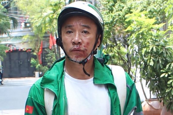 Khởi tố kẻ cướp giật nguy hiểm, kéo lê nạn nhân trên đường ở TPHCM