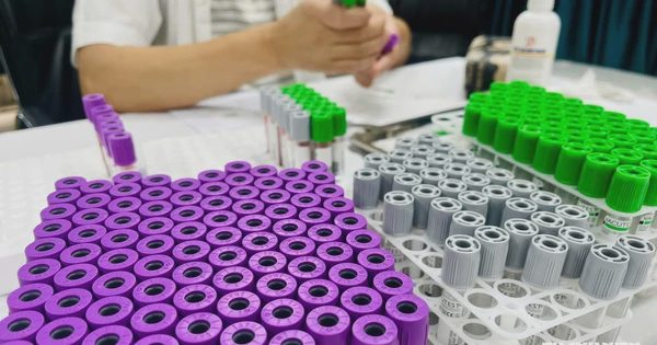 Kiểm soát chỉ định xét nghiệm trùng lặp, giảm chi phí y tế