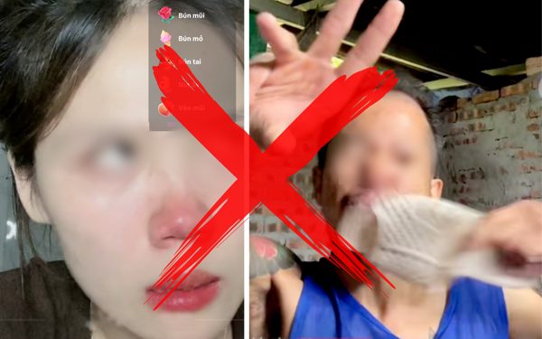 Kinh dị chuyện kiếm tiền bằng cách livestream hành hạ bản thân