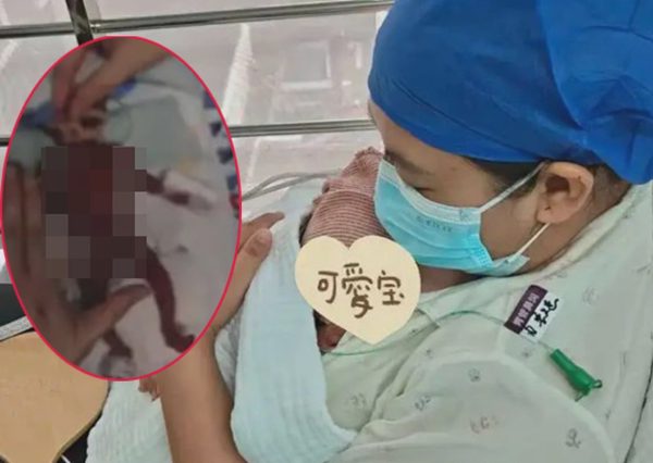 Kỳ tích xuất viện của em bé sinh non nặng 330 gram