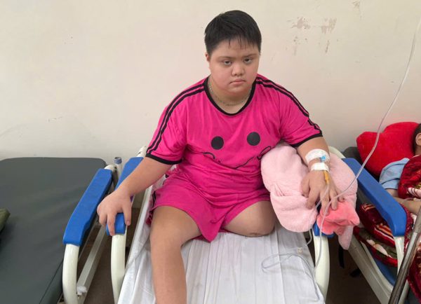Mắc hội chứng Down, bé gái 8 tuổi lại bị ung thư xương, phải cắt bỏ một chân