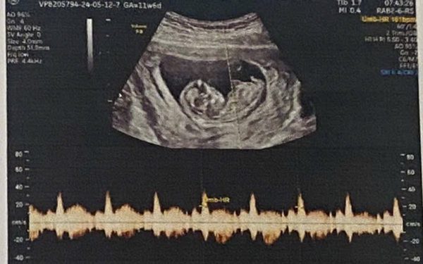 Mất cân bằng giới tính khi sinh: Cần siết việc xử phạt hành vi lựa chọn giới tính