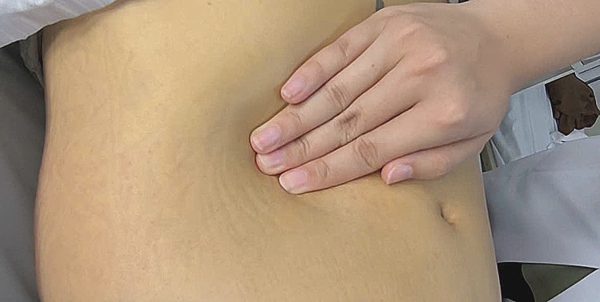 Men gan cao gấp 30 lần sau khi tự uống thuốc bắc