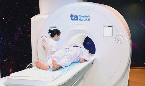 Mờ mắt tưởng do tiểu đường hóa đột quỵ