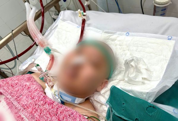 Nam thanh niên 25 tuổi suy đa tạng nguy kịch vì căn bệnh tự miễn