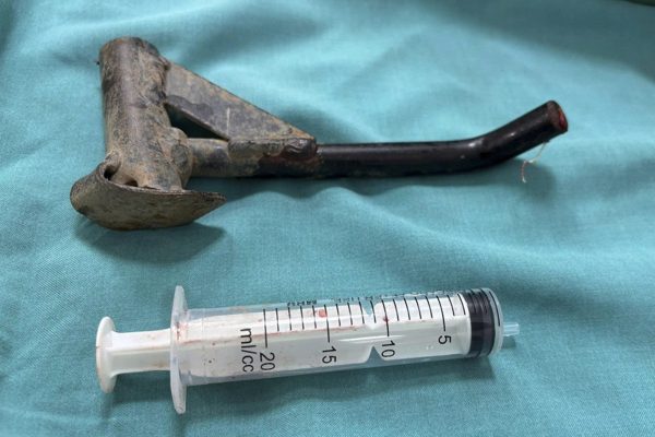 Nam thanh niên nhập viện với chân chống xe máy đâm xuyên cẳng chân