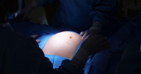 Ngỡ béo bụng, người phụ nữ 30 tuổi phát hiện 28 nhân xơ tử cung