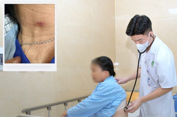Người phụ nữ đi cấp cứu với dấu hiệu lạ ở cổ